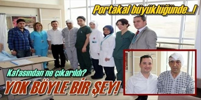 Beyninden portakal kadar tümör çıkarıldı!