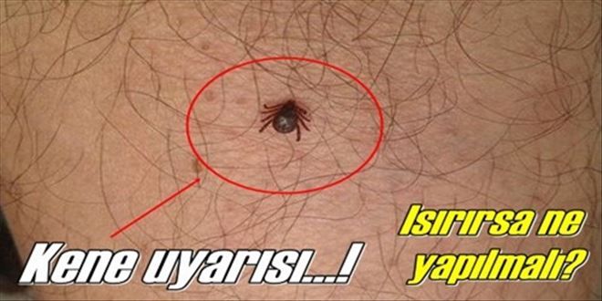 Kene uyarısı!