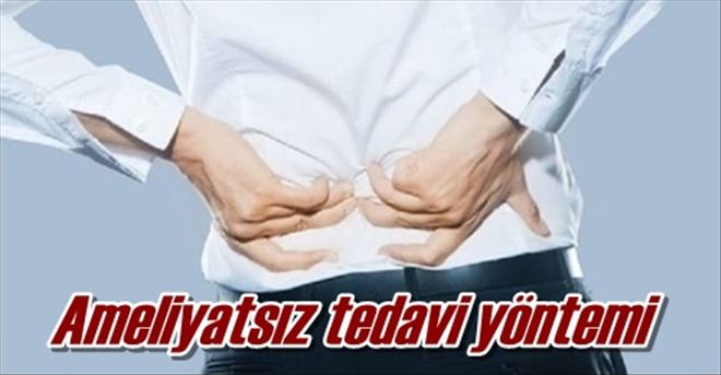 Ameliyatsız tedavi yöntemi