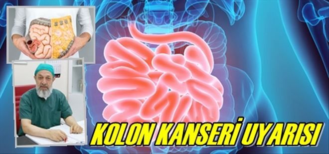 KOLON KANSERİ UYARISI