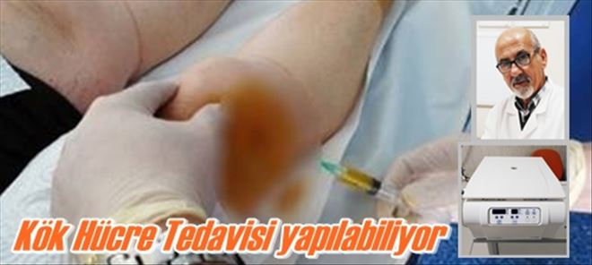 Yaşam´da PRP uygulaması başladı