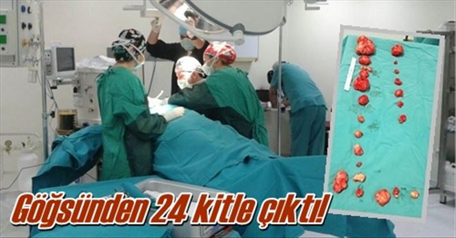 Göğsünden 24 kitle çıktı!