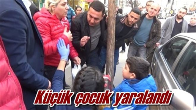 Küçük çocuk yaralandı