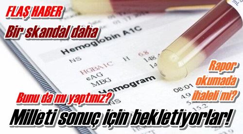 Bir skandal daha