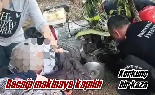 Bacağı makinaya kapıldı