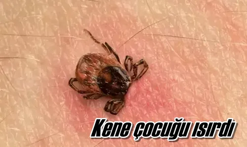 Kene çocuğu ısırdı