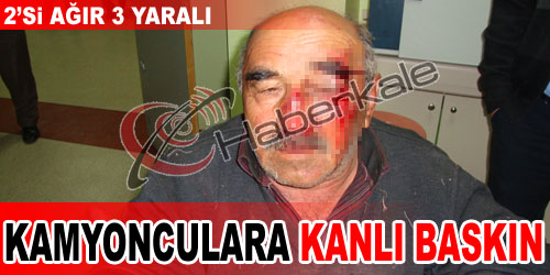 Kamyoncular Kooperatifi`ne Saldırı