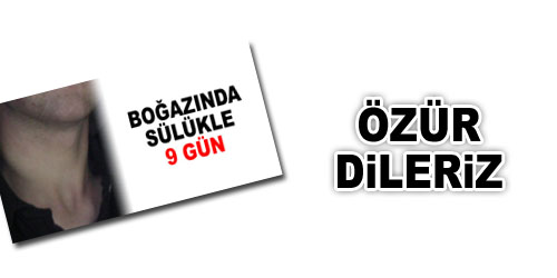 Haberkale`den Özür