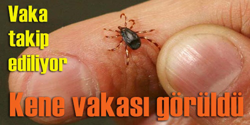 Bir Kişiyi Kene Isırdı