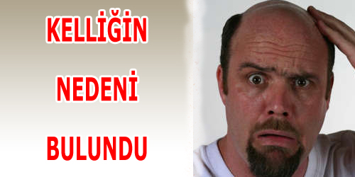 Kelliğin Nedeni Bulundu!