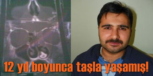 Kırıkkale