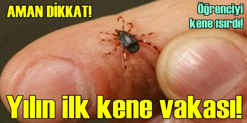 ÖĞRENCİYİ KENE ISIRDI!