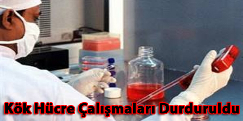 Kök Hücre Çalışmaları Durduruldu