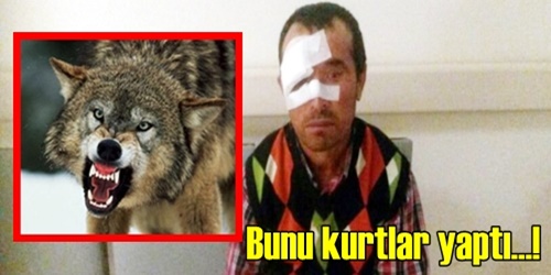 Kurtlar çobanları yaraladı